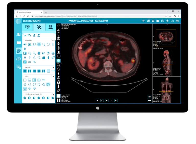 DICOM medical imaging data on Mac