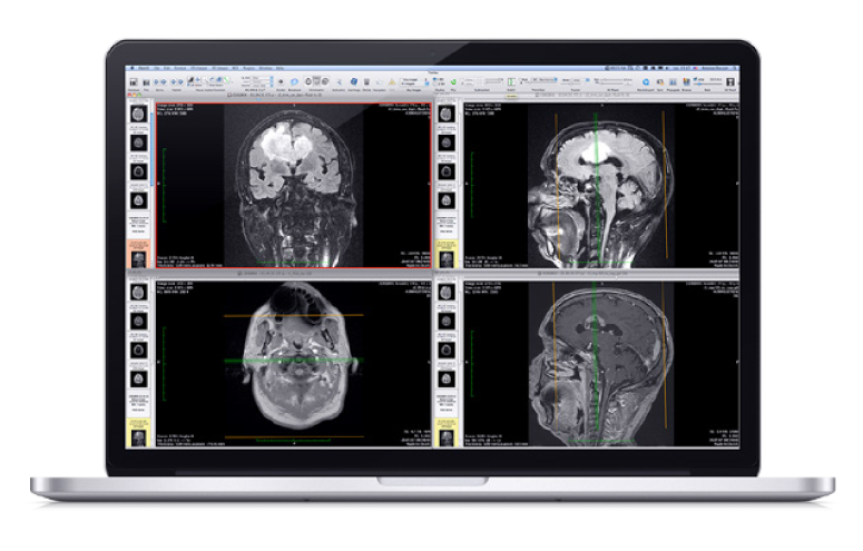 DICOM medical imaging data on Mac