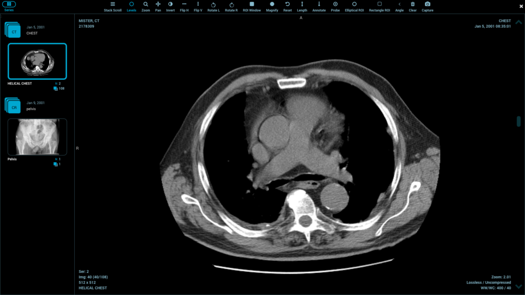 DICOM viewer library